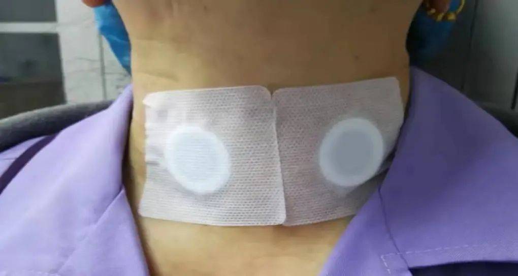 中医对甲状腺结节的治疗效果_中医论治甲状腺结节_甲状腺结节中医疗法