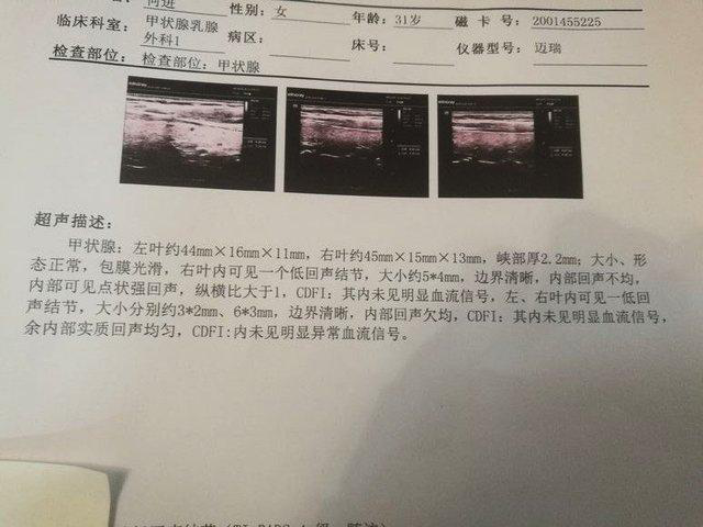 中医疗法甲状腺结节治疗_中医疗法甲状腺结节能消除吗_甲状腺结节的中医疗法