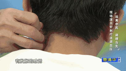 与中医疗法针灸无关的是什么针_针灸无关的是_中医针灸之术