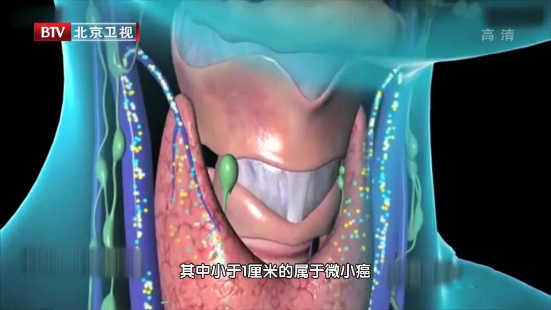 老中医治疗甲状腺的偏方秘方_治疗甲状腺最好的中医医生_治甲状腺中医有名的老中医
