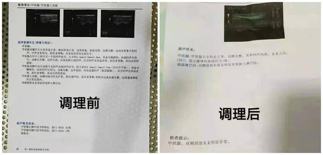 治甲状腺中医有名的老中医_老中医治疗甲状腺的偏方秘方_治疗甲状腺最好的中医医生