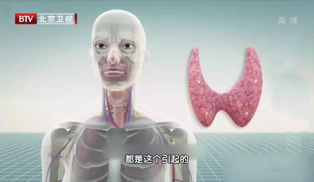 治甲状腺中医有名的老中医_老中医治疗甲状腺的偏方秘方_治疗甲状腺最好的中医医生