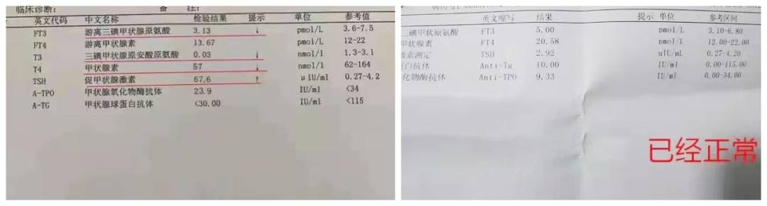 治疗甲状腺最好的中医医生_老中医治疗甲状腺的偏方秘方_治甲状腺中医有名的老中医