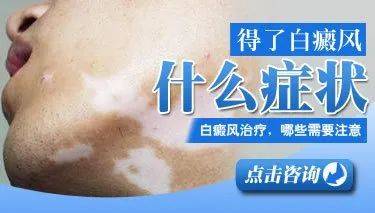 杭州看皮肤有名的中医_杭州最有名的皮肤科中医_杭州皮肤科中医排行榜