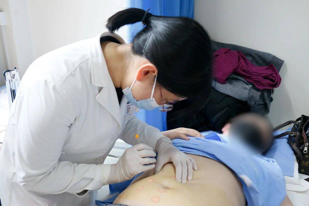 中医祛湿埋线多少钱_中医祛湿埋线有用吗_中医埋线祛湿