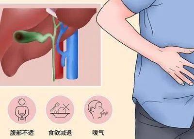中医治胆囊炎经典方_胆囊炎秘方中医报_中医治疗胆囊炎有秘方
