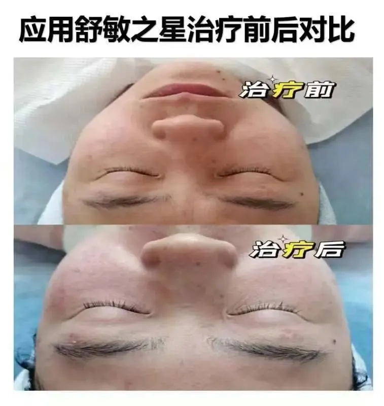 中医美容项目_中医美容项目有哪些_中医美容项目概述