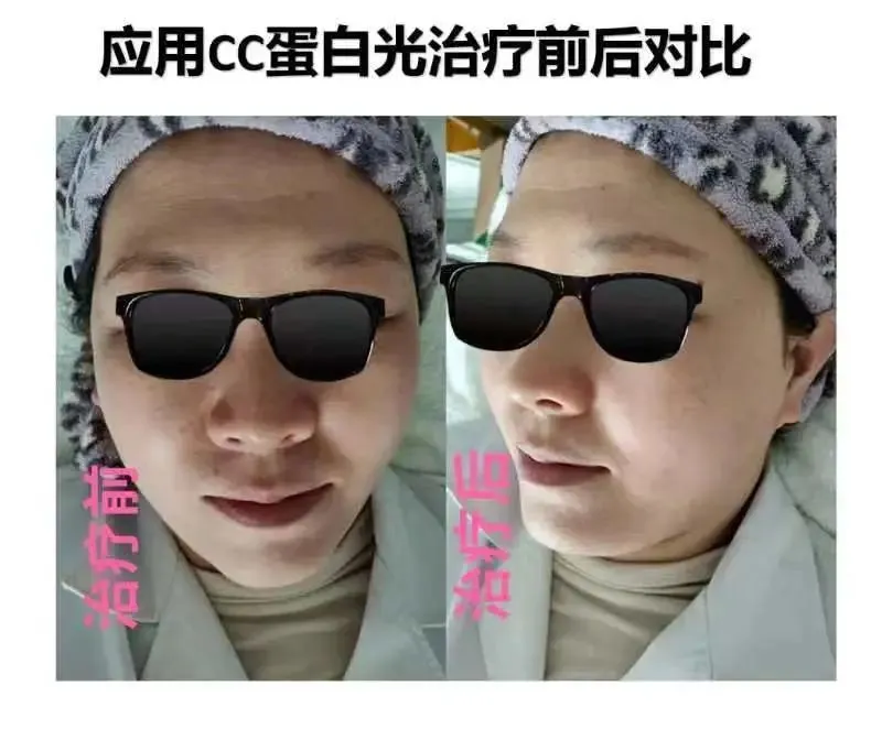 中医美容项目有哪些_中医美容项目概述_中医美容项目