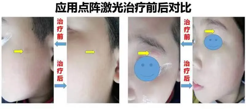 中医美容项目_中医美容项目概述_中医美容项目有哪些
